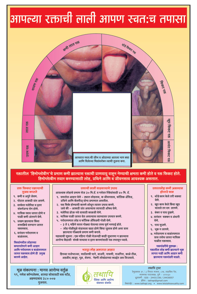 anaemia-detection-mirror-chart